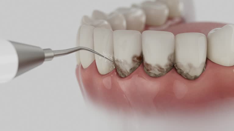 Trusted Teeth Cleaning And Checkup service in Aptos Hills-Larkin Valley, CA - Dentist Open Now